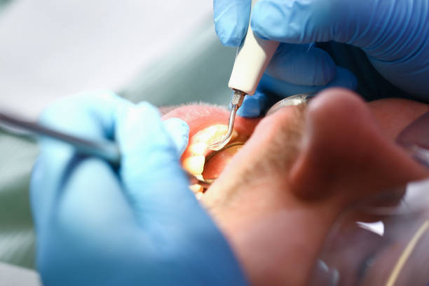 Best Emergency Broken Tooth Repair in Uintah, UT